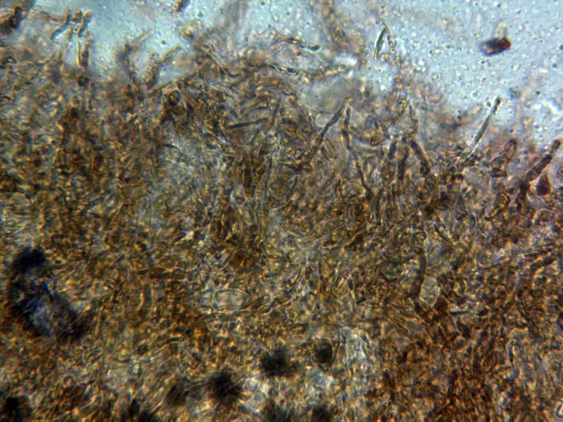 Boletus aereus 11 - Suprapellis x 400